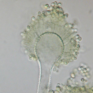 300Aspergillus_flavus.jpg