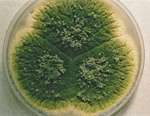 300px-Aspergillus_parasiticus_UAMH3108.jpg