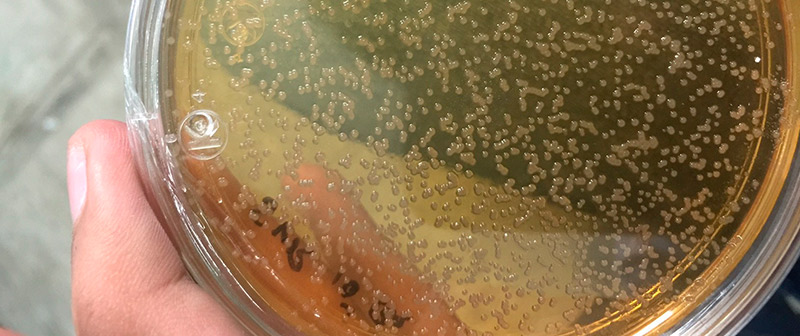 800x300_Bacteria_123.jpg