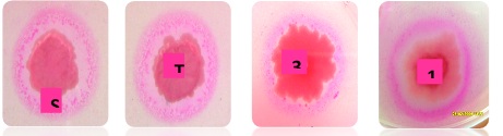 Produccion de lipasas en Bacillus Subtilis. Foto Cortesía