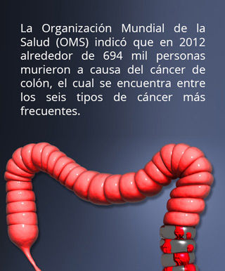 OMS cancer colon info01