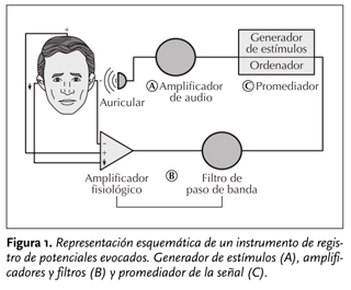 diagrama cabina sordera neonatos