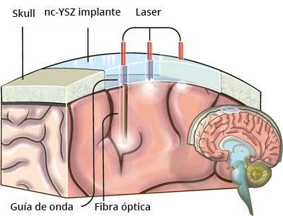 Esquema del concepto ventana al cerebro. Imagen Cortesia2