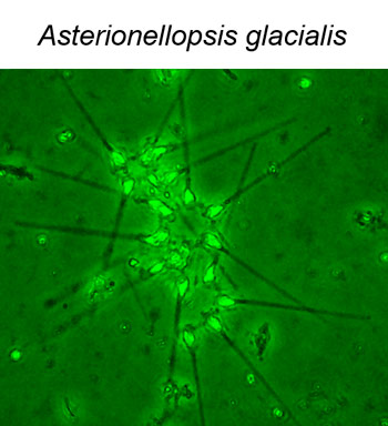 1 Asterionellopsis glacialis2609